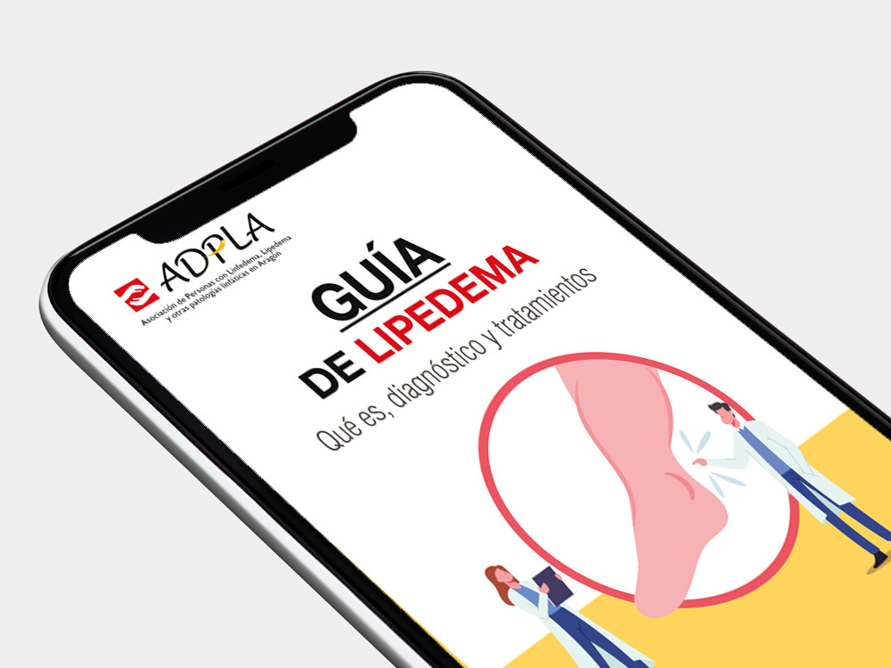 ADPLA presenta su ‘Guía de lipedema’ en formato digital