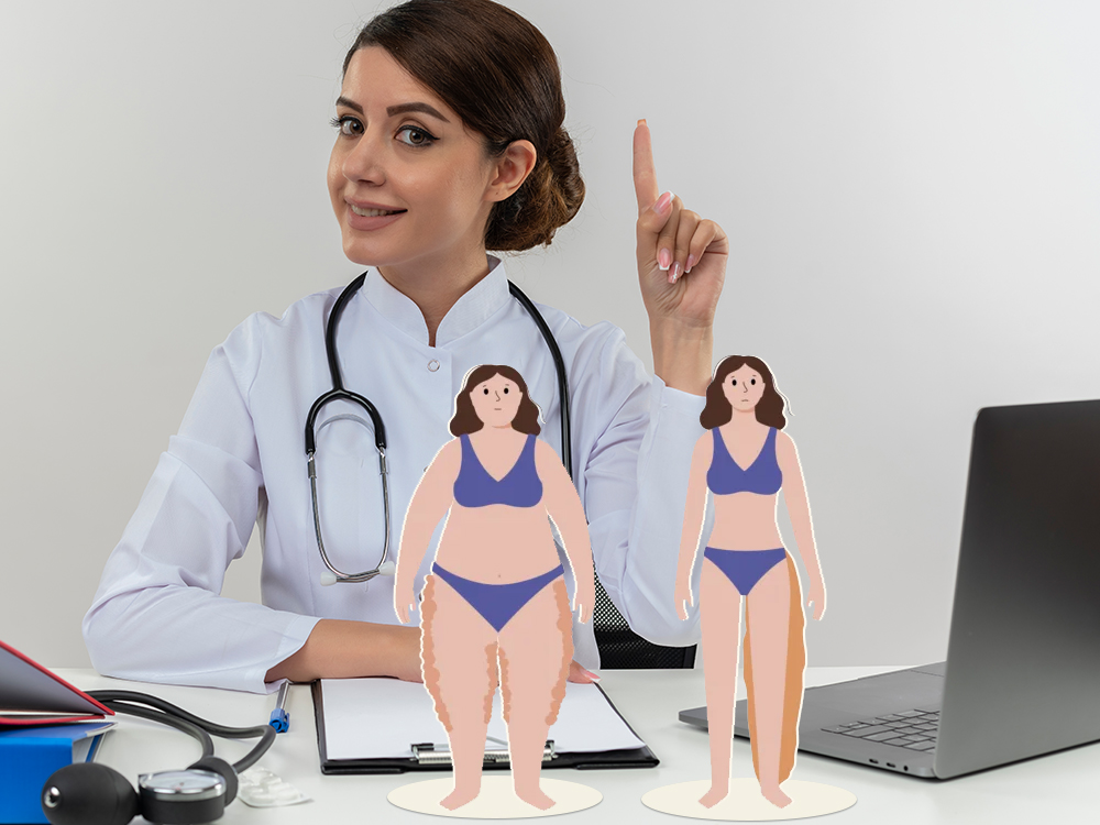 Linfedema y lipedema: dos enfermedades distintas que con frecuencia se confunden